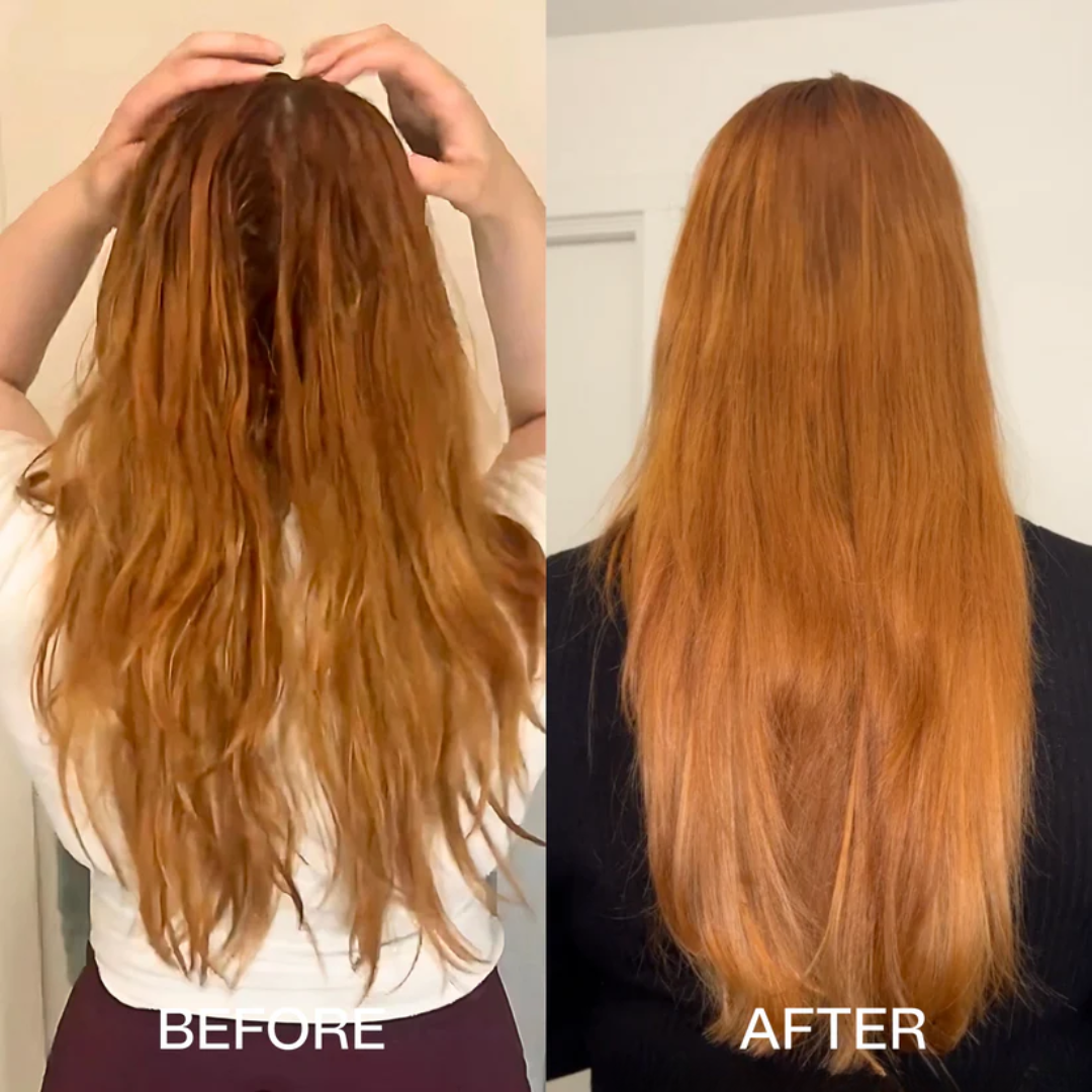 KALVRO DERMA-PEPTIDE HAIR THERAPY