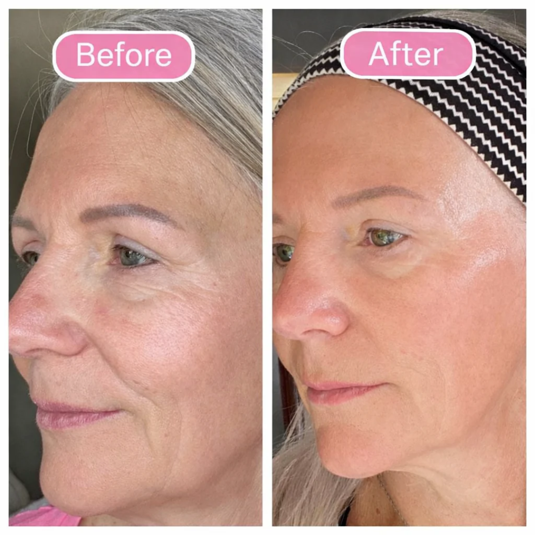 Kalvro™ Lymphatic Contour Face Brush