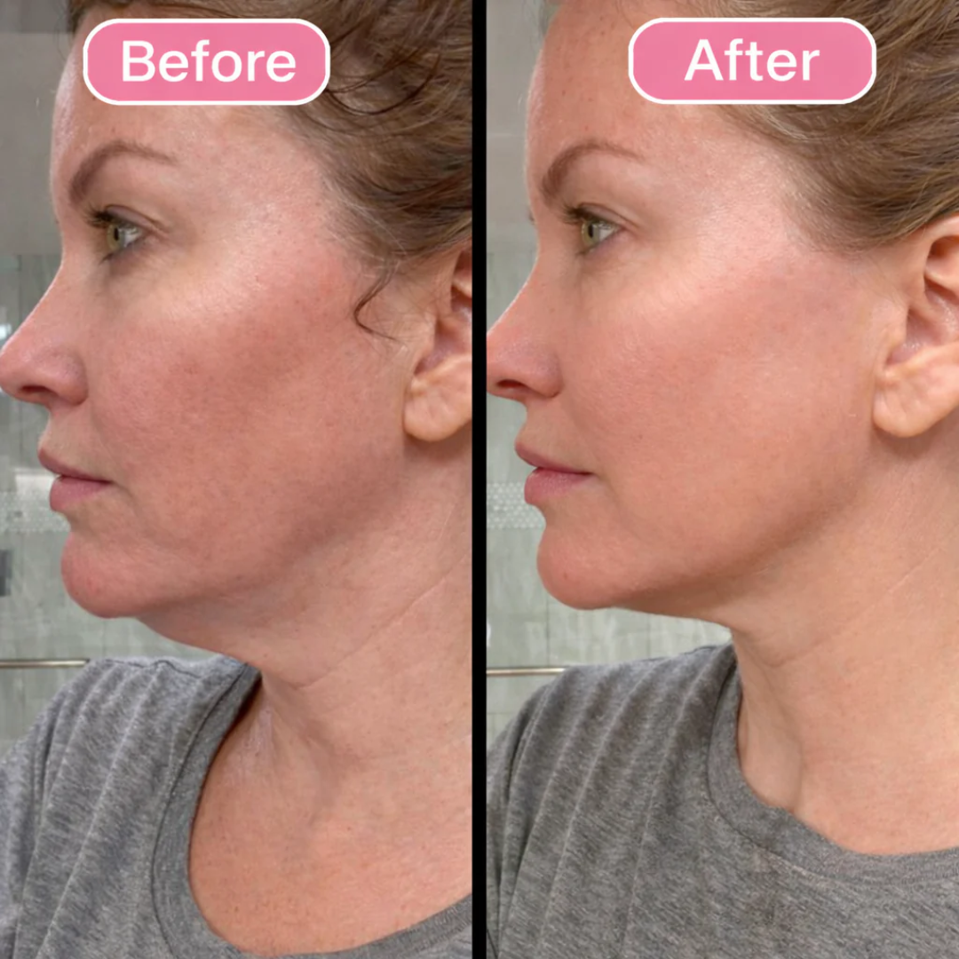 Kalvro™ Lymphatic Contour Face Brush