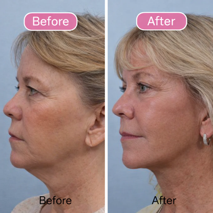 Kalvro™ Lymphatic Contour Face Brush
